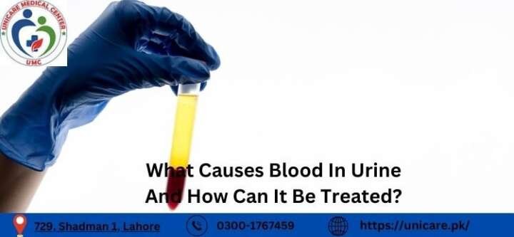 What Causes Blood In Urine And How Can It Be Treated? What Causes Blood In Urine And How Can It Be Treated?