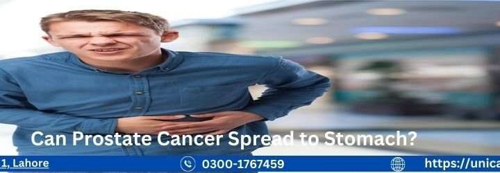 Can Prostate Cancer Spread to Stomach